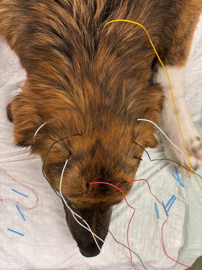 Hastada EEG elektrotları